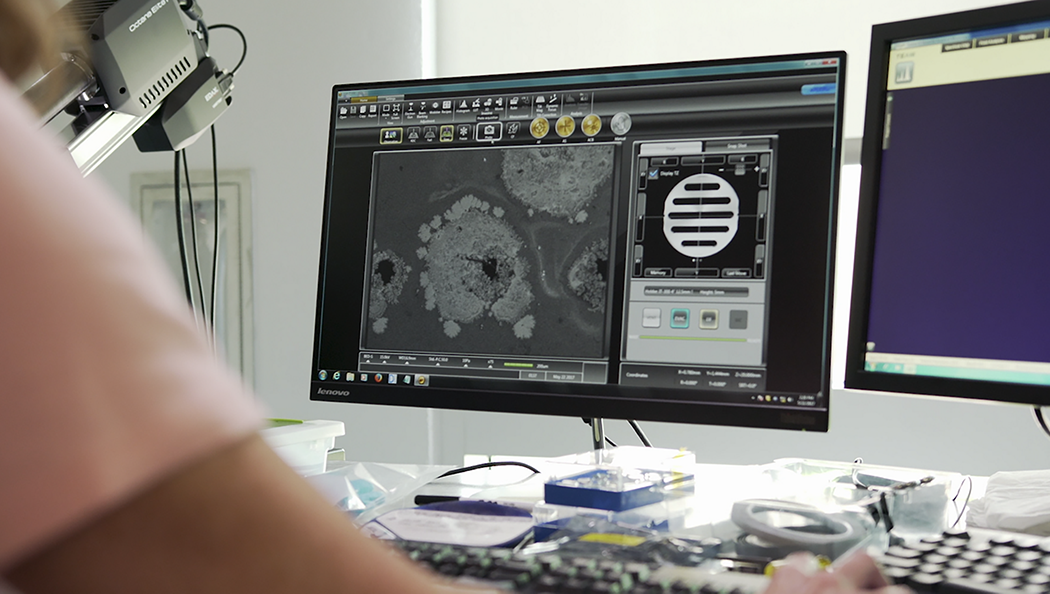 Des chercheurs recherchent un glaucome dans des scanners des yeux sur un ordinateur Lenovo