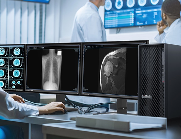Lenovo ThinkStation P348 Tower workstation alongside two monitors with medical imaging.