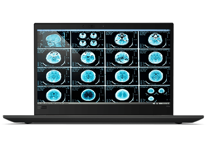 Lenovo ThinkPad 52s front view, medical