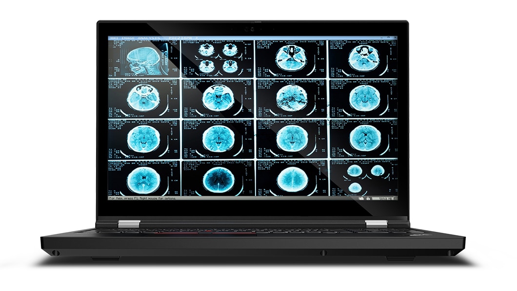 The ThinkPad T15g laptop for medical imaging